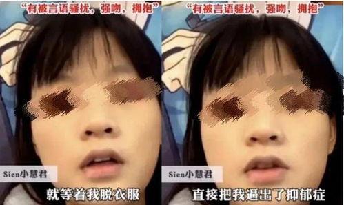 小慧君吃瓜全过程视频,笑料百出，精彩瞬间回顾